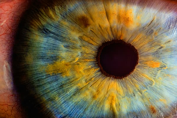 Synthetic Retina Images Dataset on Opendatabay data marketplace 