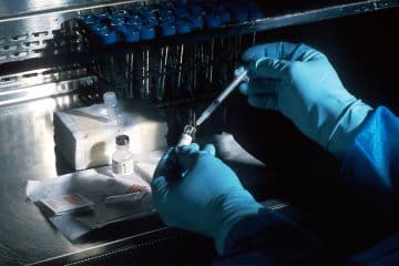 Liver Health and Hepatitis C Diagnostic Dataset Dataset on Opendatabay data marketplace 