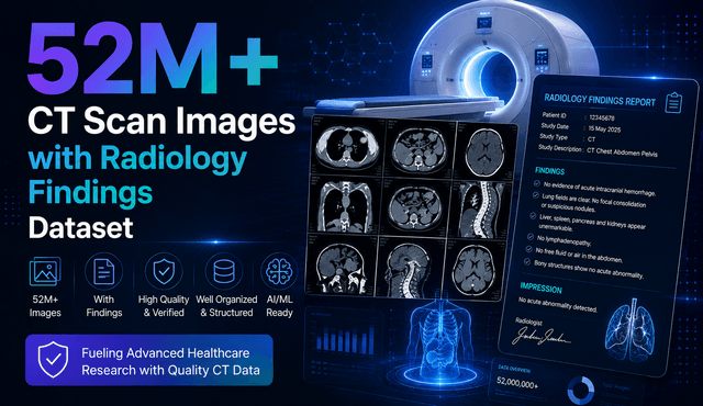 52M+ CT Scan Images with Radiology Findings Dataset Dataset on Opendatabay data marketplace