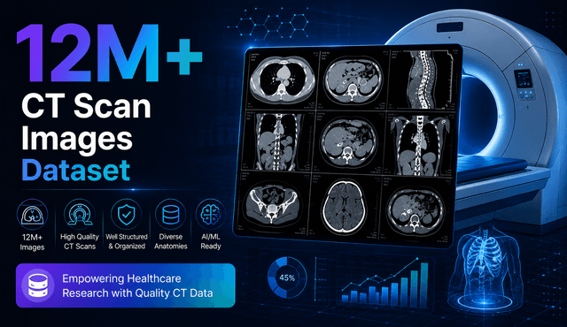 12M+ CT Scan Images Dataset Dataset on Opendatabay data marketplace