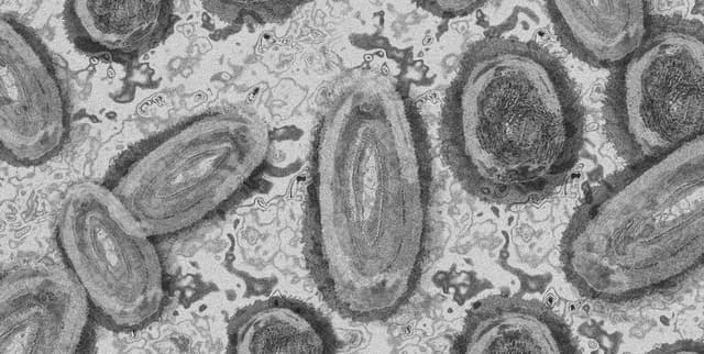 Public Health Monkeypox Dataset Dataset on Opendatabay data marketplace