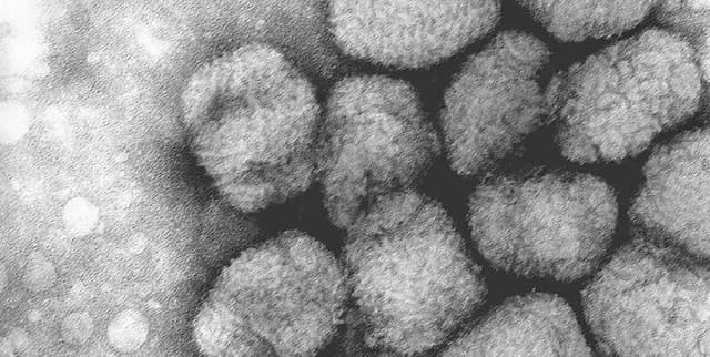 Historical Variola Virus Death Rates in London Dataset on Opendatabay data marketplace