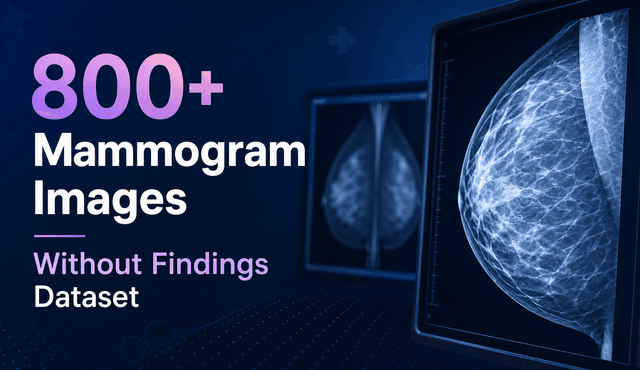 800+ Mammogram Images Without Findings Dataset Dataset on Opendatabay data marketplace