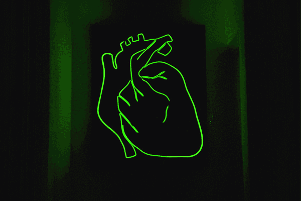Heart Attack Prediction Dataset Dataset on Opendatabay data marketplace