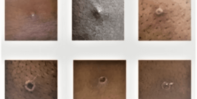 Daily Monkeypox Case Characteristics and Trends Dataset on Opendatabay data marketplace