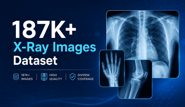 187K+ X-Ray Images Dataset Dataset on Opendatabay data marketplace