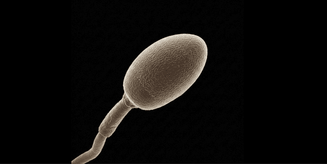 Human Sperm Shape Classification Data Dataset on Opendatabay data marketplace