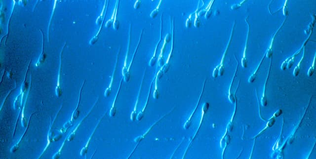 Global Male Fertility Reference Data Dataset on Opendatabay data marketplace