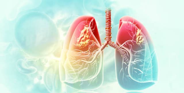 Respiratory Disease Patient Dataset Dataset on Opendatabay data marketplace