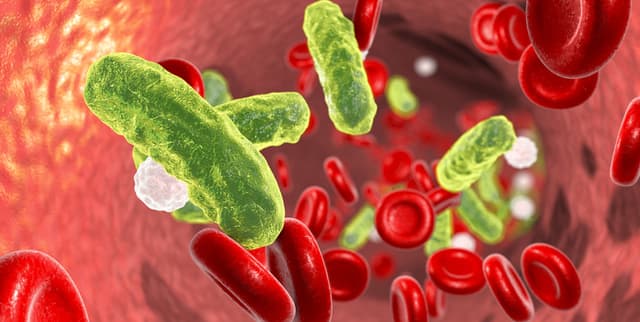 Sepsis Patient Outcomes Dataset Dataset on Opendatabay data marketplace