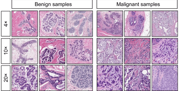 Breast Cancer Wisconsin Diagnostic Features Dataset on Opendatabay data marketplace