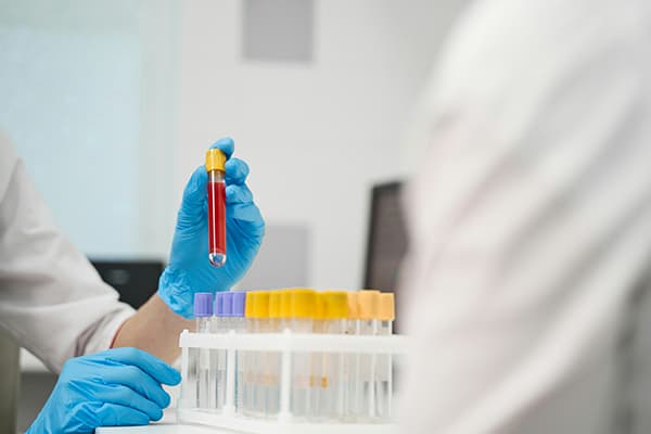 Synthetic Anemia Types Dataset Dataset on Opendatabay data marketplace