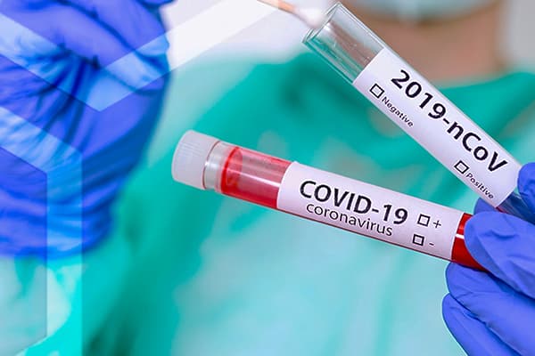 UK National and Regional COVID-19 Death Tracking Data Dataset on Opendatabay data marketplace