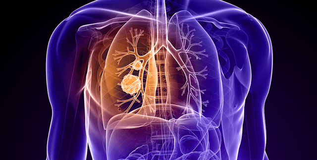 Lung Cancer Risk Factors Dataset Dataset on Opendatabay data marketplace