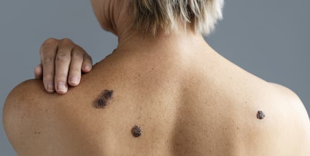 Historical Smallpox Mortality and Life Expectancy Index Dataset on Opendatabay data marketplace