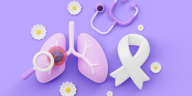 Clinical Lung Cancer Outcomes Dataset on Opendatabay data marketplace