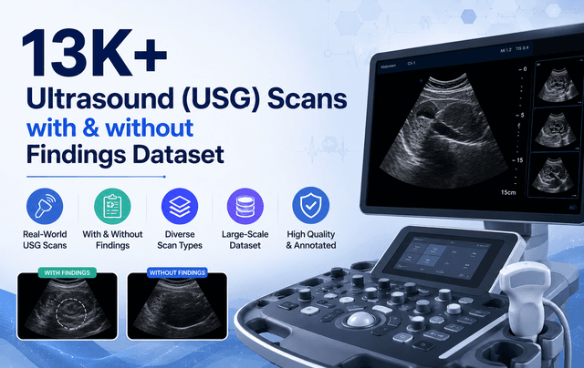 13K+ Ultrasound (USG) Scans with & without Findings Dataset Dataset on Opendatabay data marketplace