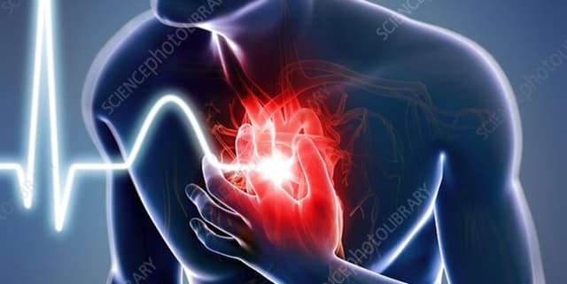 Heart Attack Prediction Dataset Dataset on Opendatabay data marketplace