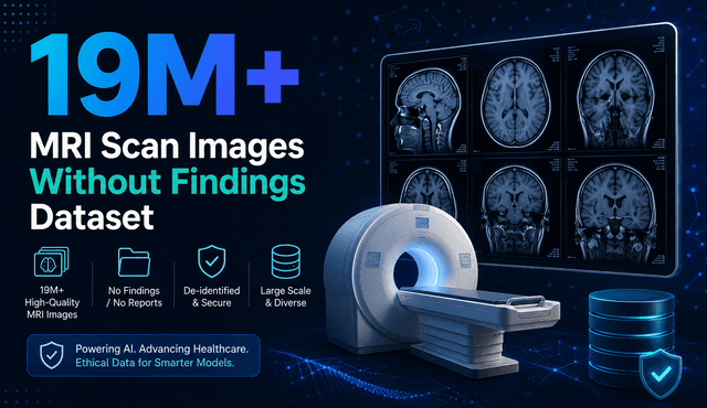 19M+ MRI Scan Images Without Findings Dataset Dataset on Opendatabay data marketplace