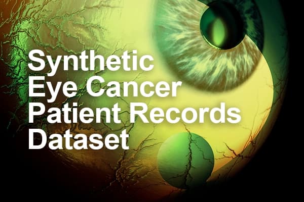 Synthetic Eye Cancer Patient Records Dataset Dataset on Opendatabay data marketplace