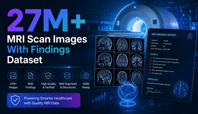 27M+ MRI Scan Images With Findings Dataset Dataset on Opendatabay data marketplace
