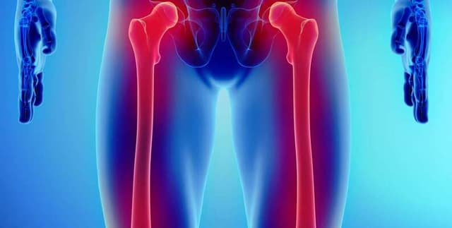 Bone Tumour Clinical Dataset Dataset on Opendatabay data marketplace