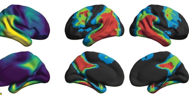 Alzheimers FTD Microglial Biomarker Panel Dataset on Opendatabay data marketplace