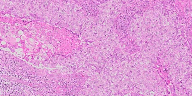 Biglycan Cancer Biomarker Visual Data Dataset on Opendatabay data marketplace