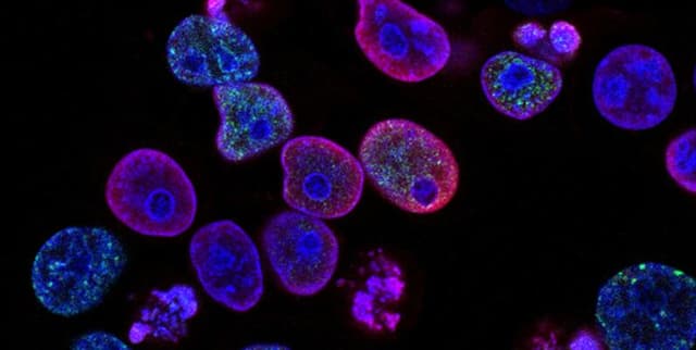 Country Cancer Incidence Report Dataset on Opendatabay data marketplace