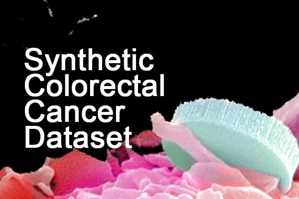 Synthetic Colorectal Cancer Global Dataset Dataset on Opendatabay data marketplace