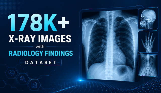 178K+ X-Ray Images with Radiology Findings Dataset Dataset on Opendatabay data marketplace