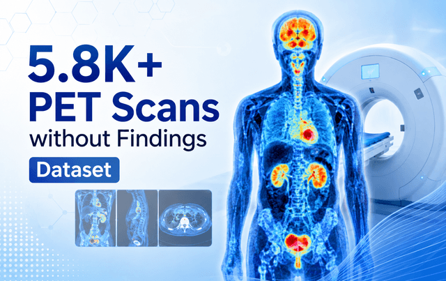 5.8K+ PET Scans without Findings Dataset Dataset on Opendatabay data marketplace