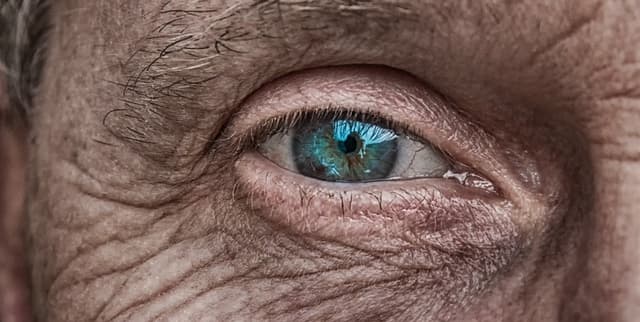 United States Vision Health Surveillance Data Dataset on Opendatabay data marketplace