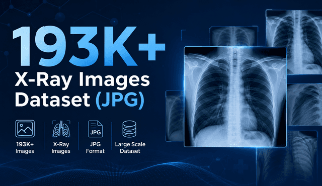 193K+ X-Ray Images Dataset (JPG) Dataset on Opendatabay data marketplace