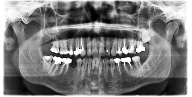Dental Radiography AI Dataset Dataset on Opendatabay data marketplace