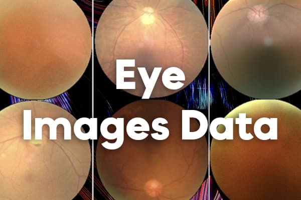 Eye Diseases Classification Dataset Dataset on Opendatabay data marketplace