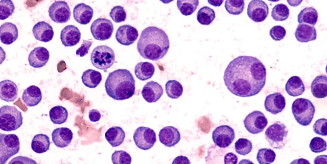 Kyle MGUS Longitudinal Survival Data Dataset on Opendatabay data marketplace