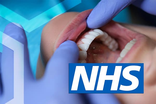 NHS Payments to Dentists Dataset Dataset on Opendatabay data marketplace