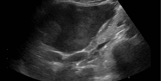 Deep Learning Liver Analysis Dataset Dataset on Opendatabay data marketplace